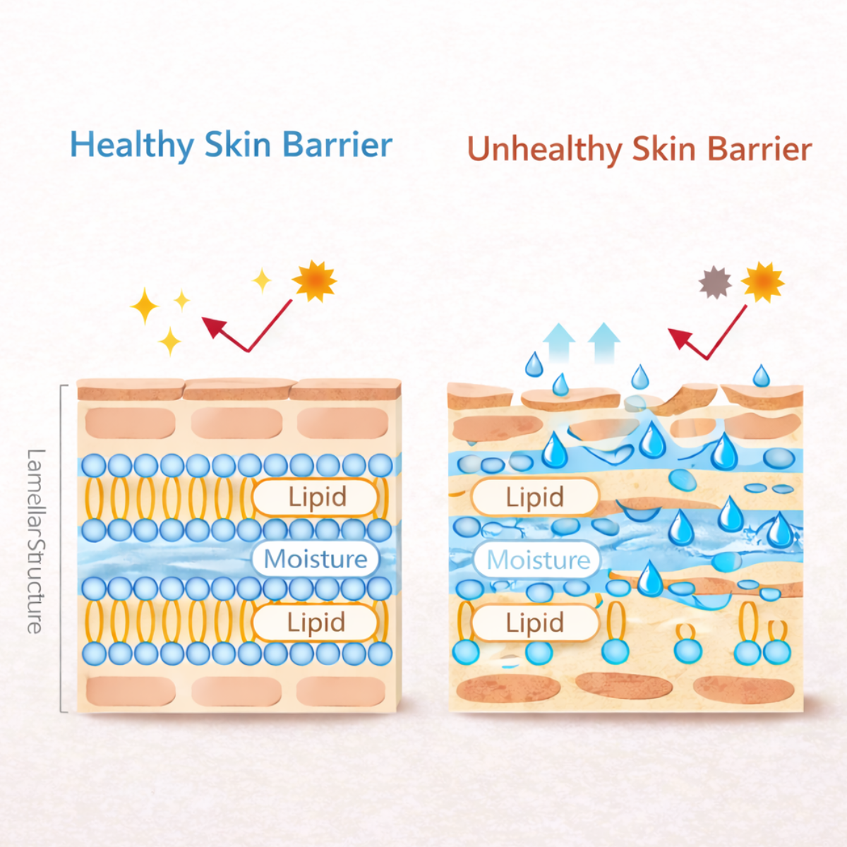 Signs Your Skin Barrier Needs Support